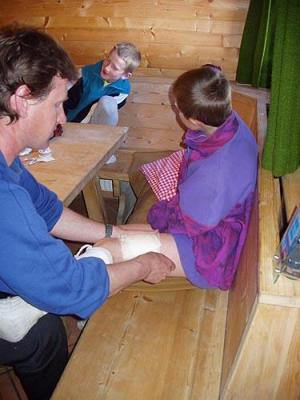 Popáleniny 2. stupně