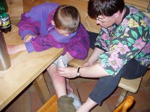 Popáleniny 2. stupně